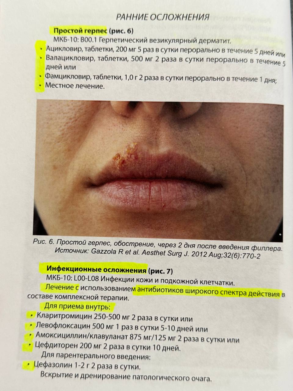 А каким аппаратом пользуетесь ?...