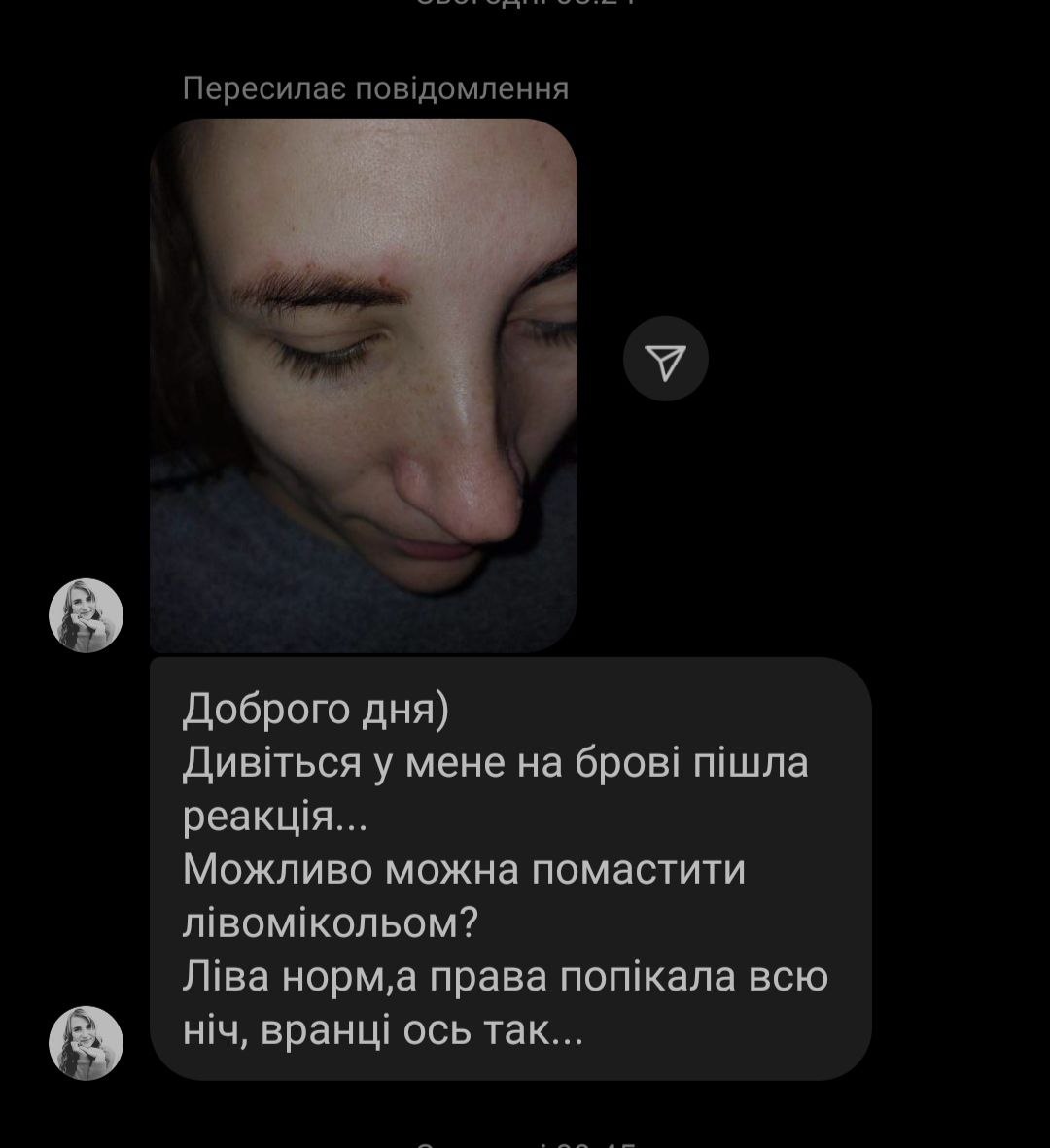 Добрий ранок, дівчата підкажіть що можна порадити?...