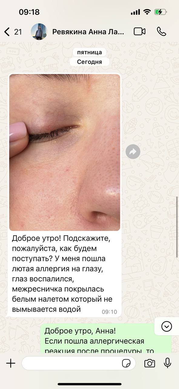 Девушки, всем привет!
Подскажите, что делать в случае, если у клиентки появилась аллергия после ламинирования...