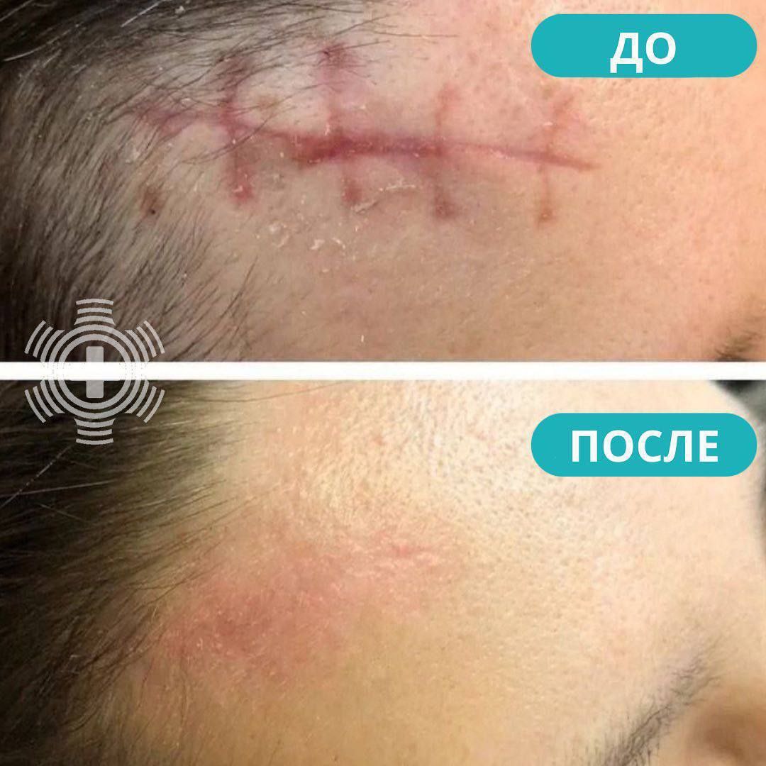 Да...