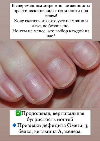 Про ногти столько всего разного пишут. Сколько врачей, столько и версий    выбирайте какой признак вам...