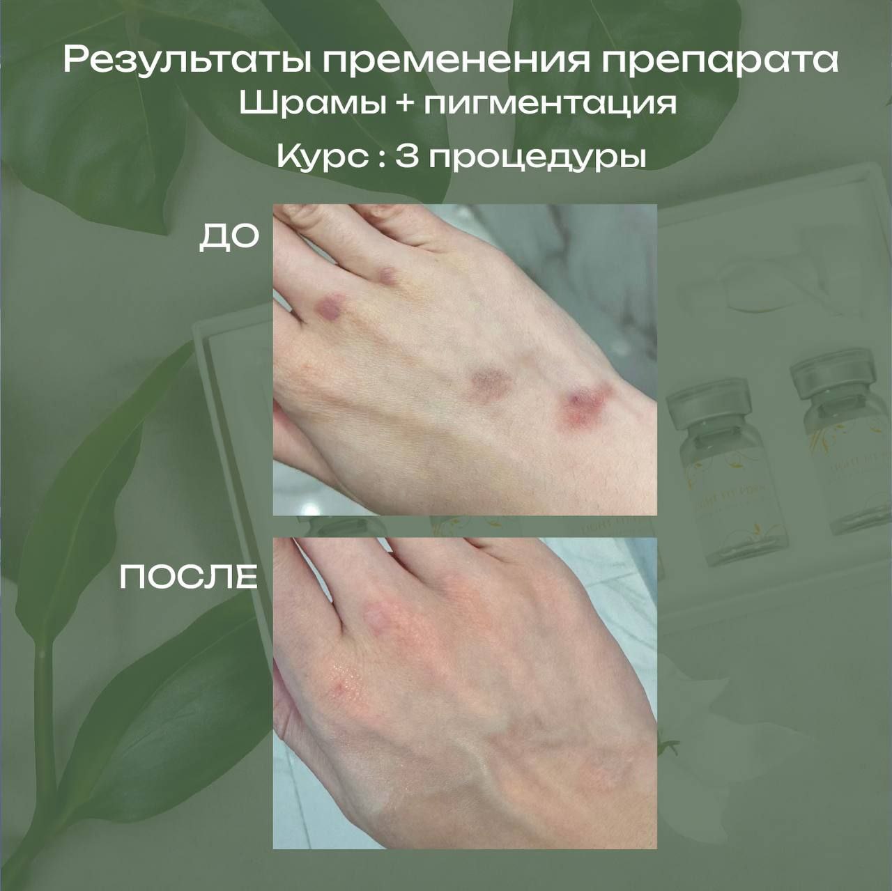 Здравствуйте Алина. К сожалению мы, обучение официально не проводим, так как являемся заводом производителем....