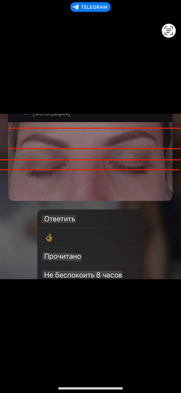 Пусть для начала глаза откроет , они тоже разные...