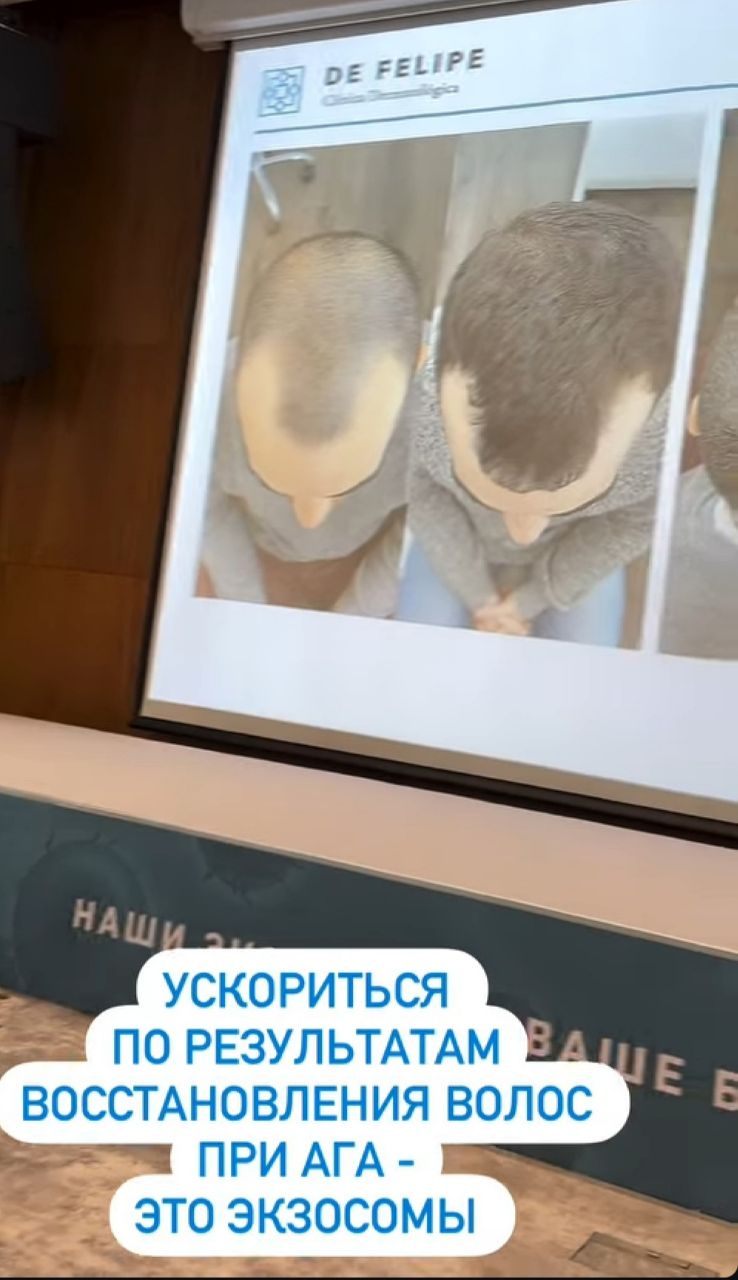 Странно что нет сертификатов

А какой конгресс тогда устроили наши трихологи, вот на днях был, они все...