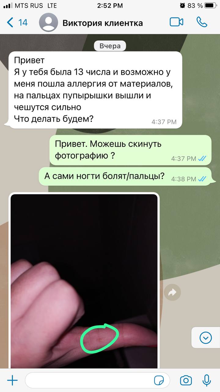 Все, хорошо спасибоУ меня тоже такая проблема. Особенно на первых двух ногтях не считая большого пальца....