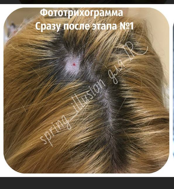 Фото из интернета, таких участка 2...