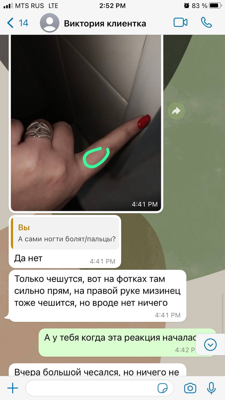 Девочки, всем приветик. Ко мне пришла новая клиентка на покрытие. Пишет что пошла аллергия. У неё была...