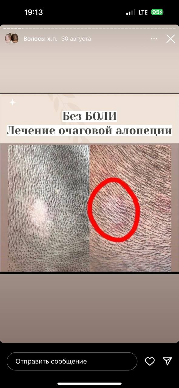 Здравствуйте, это хороший знак. Синхронизация. Значит мин на Вас действует (бывает, что не действует)....