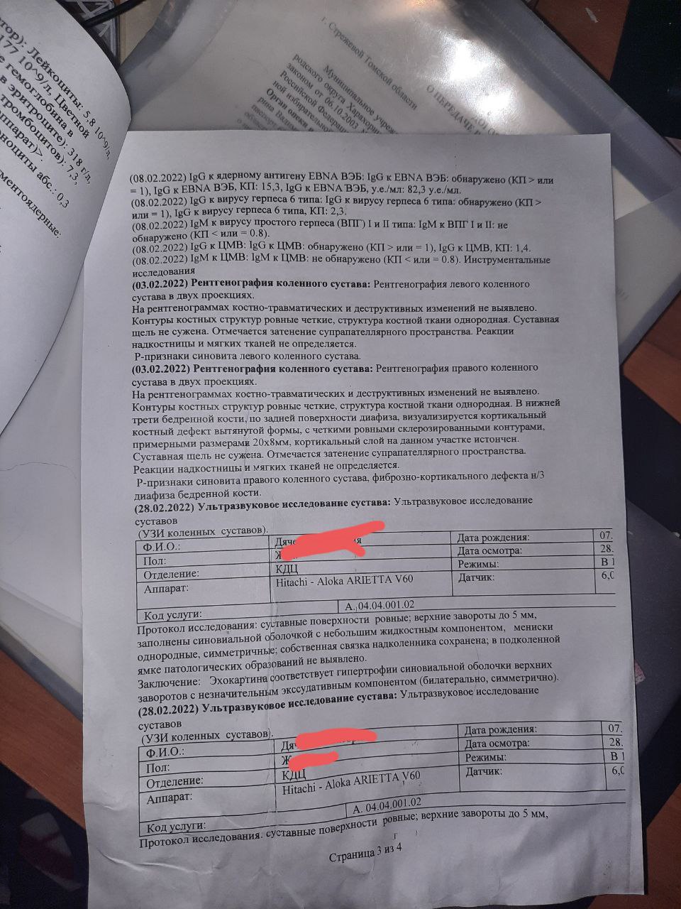 Просто пока выявили что есть, так-же то что я писала выше про колено поставили сегодняУ меня с детства...