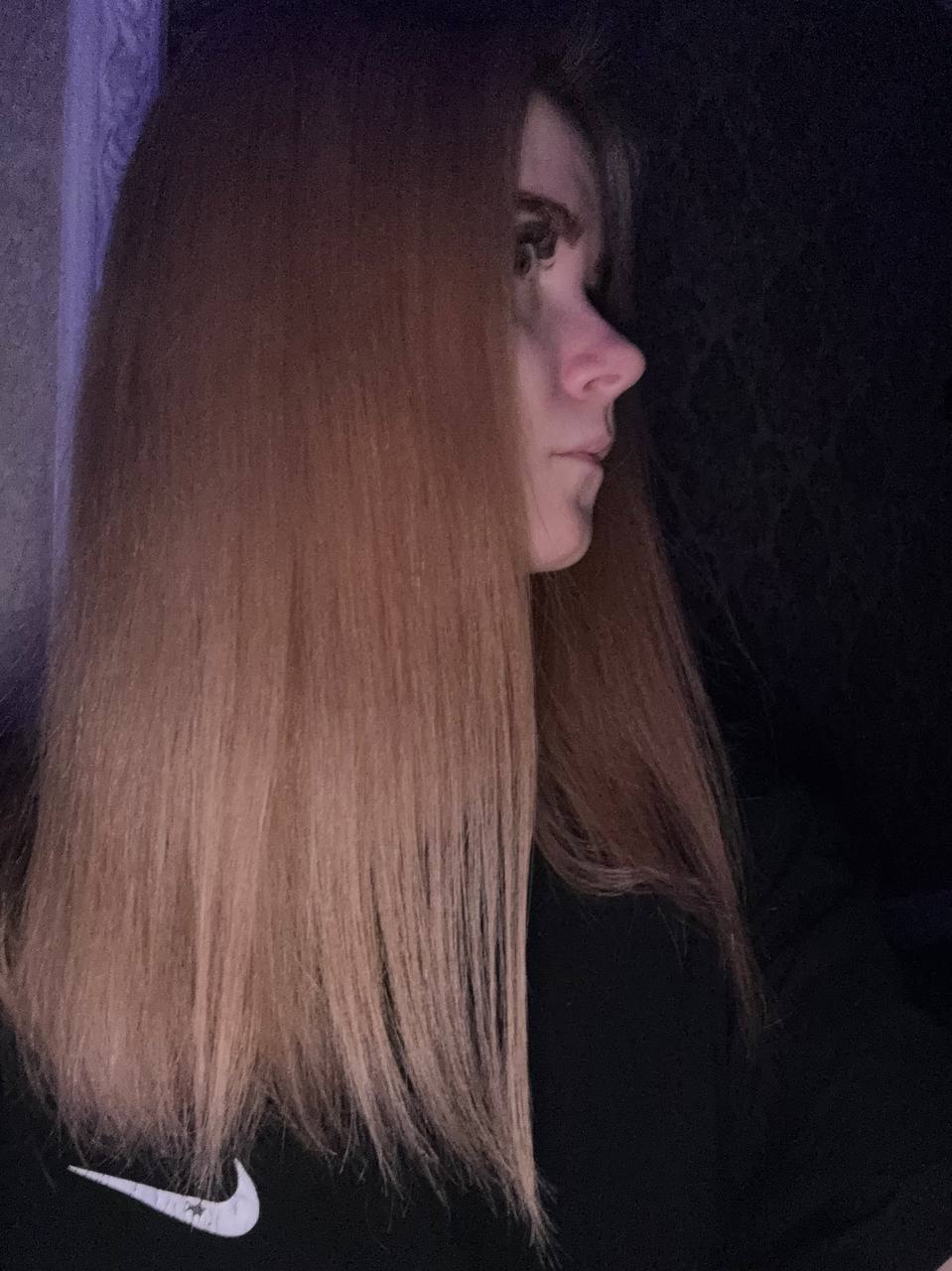 Сказала что это точно не АГА ибо пробор у меня не разъезжаетсяИ на затылке как и положено волос меньше...