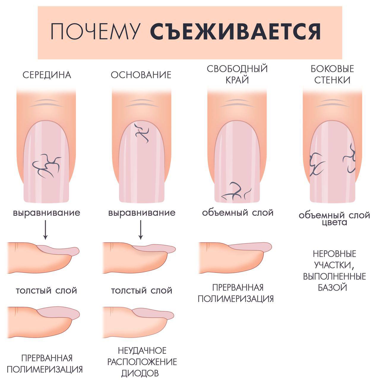 Камера на себя слегка , я фотографирую с широкоформатным макроИ смотрю на каждый пальчик в камере, если...