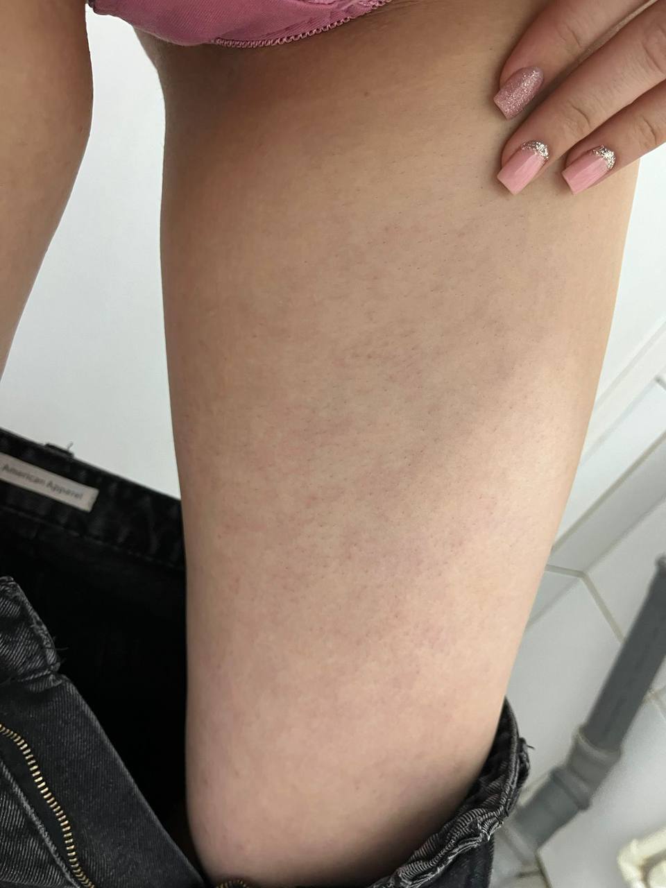 Девочки подскажите пожалуйста девочка ходит ко мне не первый раз, вот такое появилось на руках и ногах
Говорит...