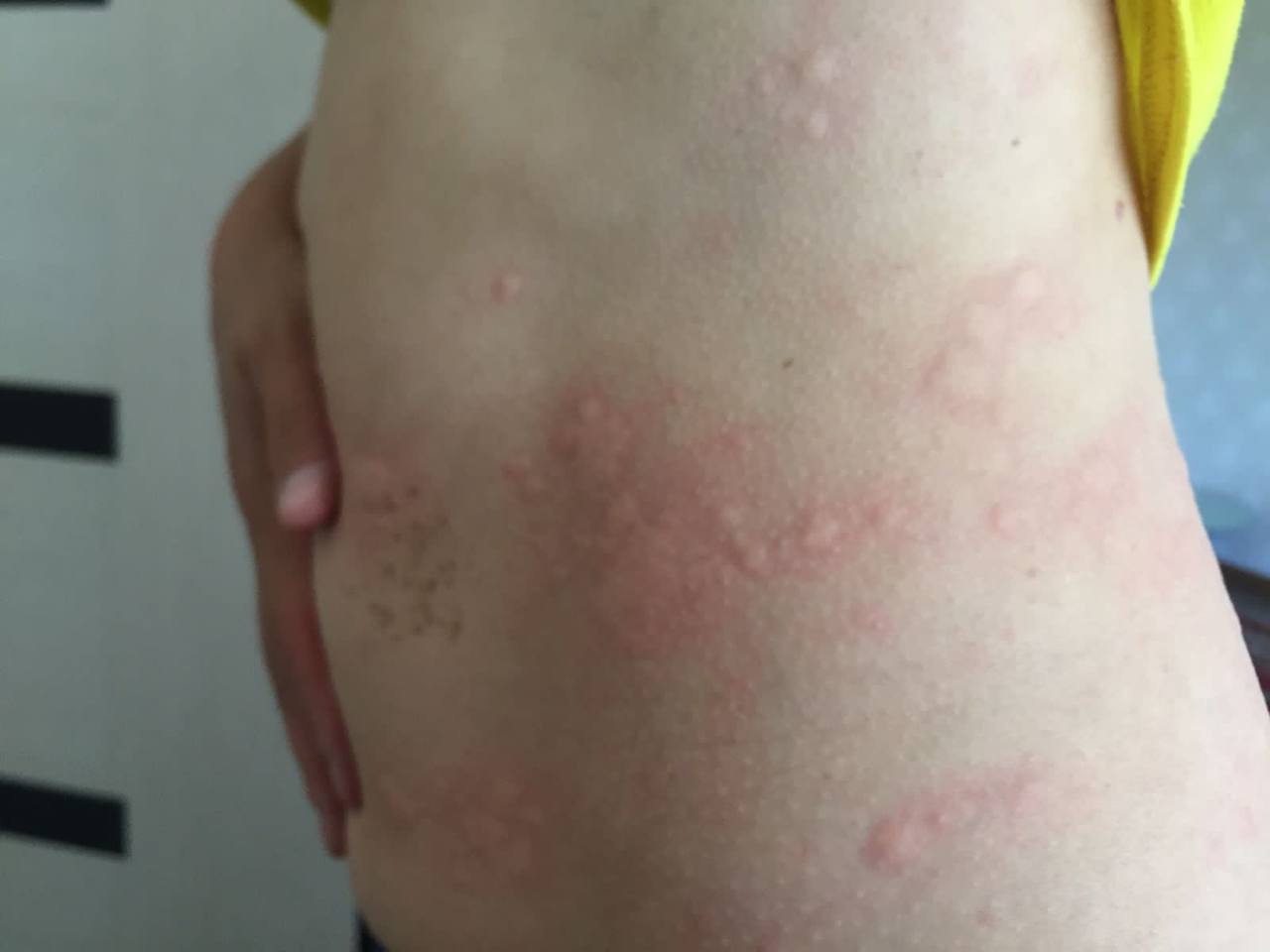 Девочки,  всем доброе утро! Подскажите пожалуйста клиентка утверждает что после пм Бровей ее высыпало,...