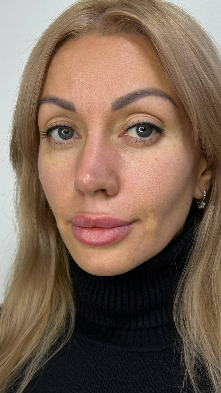 Сначала промываю с мылом, потом в раствор на минут 15, промываю, высушиваю и в контейнер складываю...