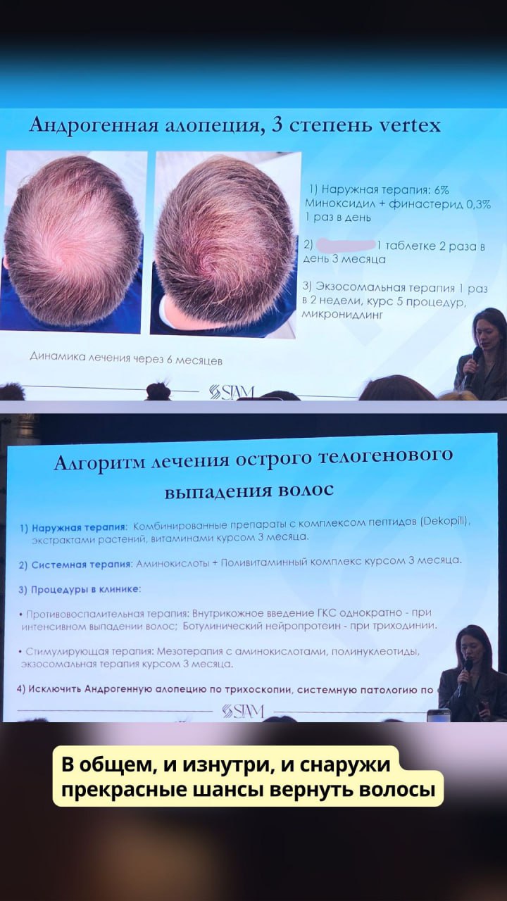  Слайды с конгресса по лечению выпадения волос 
 
Фотографии не как часто бывает до светлее, после темнее,...