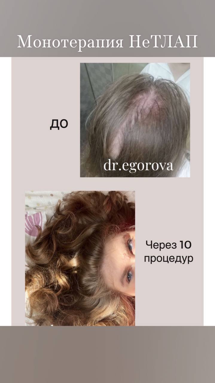 Верите, что это через 2.5-3 мес ?   ...
