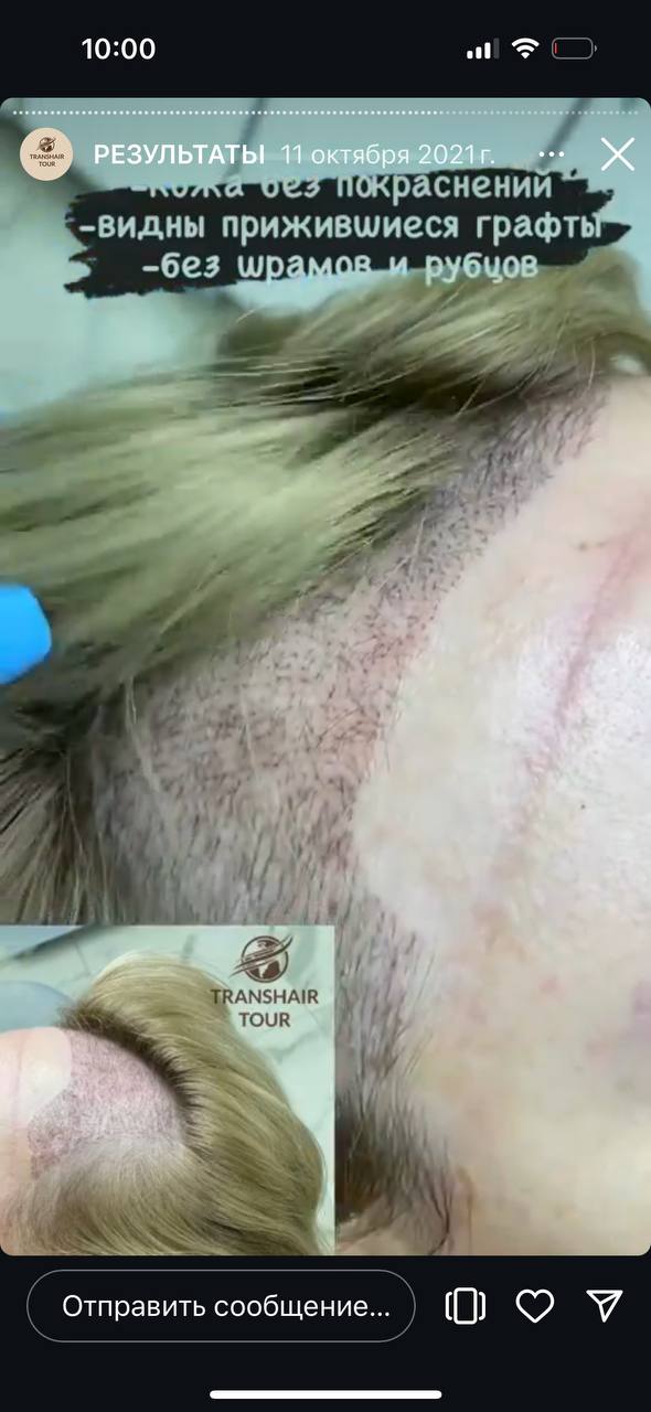 7 пшиков это 1 мл
Только что замерила специально...