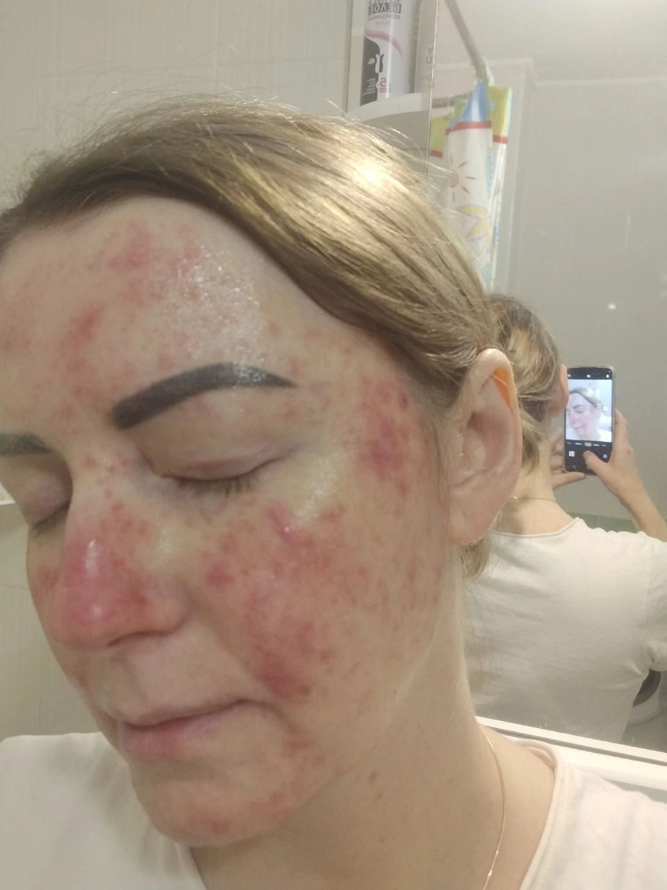 Здравствуйте,  ничего не получается написать..все удаляют(Здравствуйте   , коллеги...какую тактику ведения...