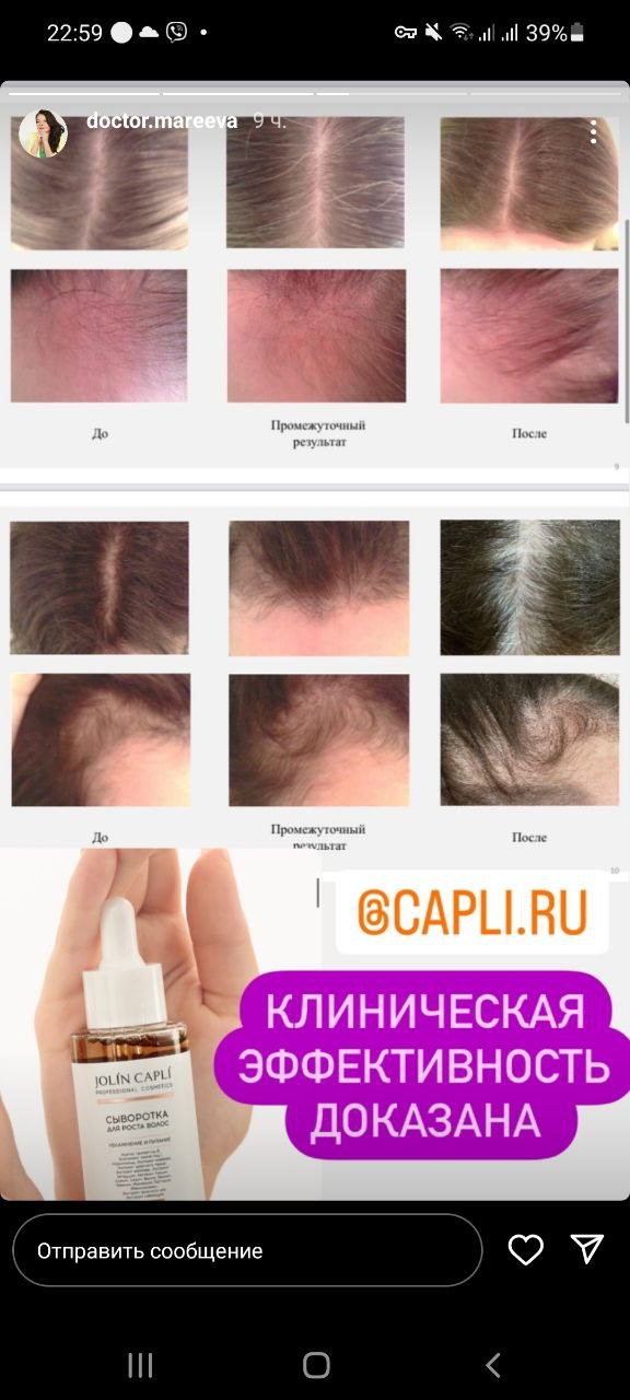 Просто 2 дня назад было на 2 тыс дешевле.. что могло произойти, что не на 200р, не на 500, а на целых...