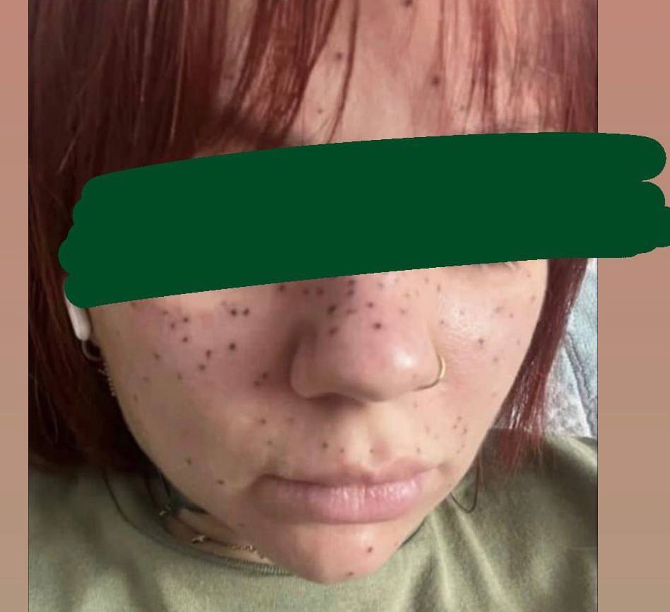 Не надо вообще этого делать...