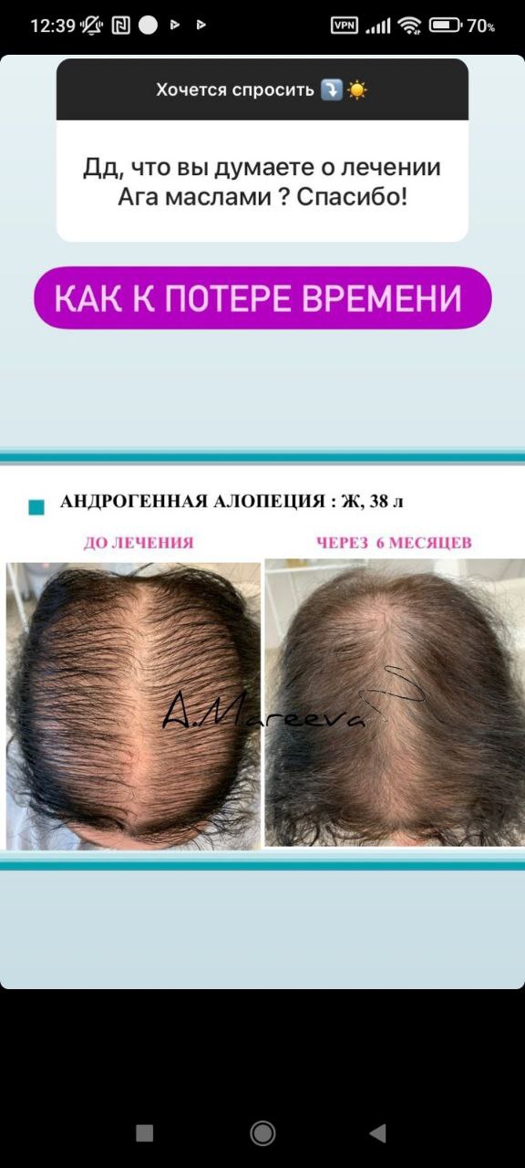 Да ,то что Ага ,в это верится ,а вот ,то что  куча дорогих косметических  средств и все то они работают...