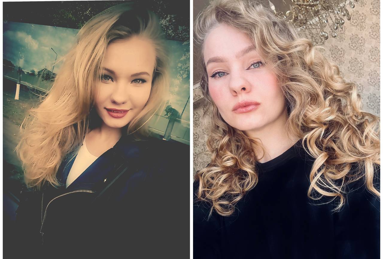 Добрый день, да Вам нужно изучить закреп, там тонна полезности. Вот для сравнения, первое фото до КГМ...
