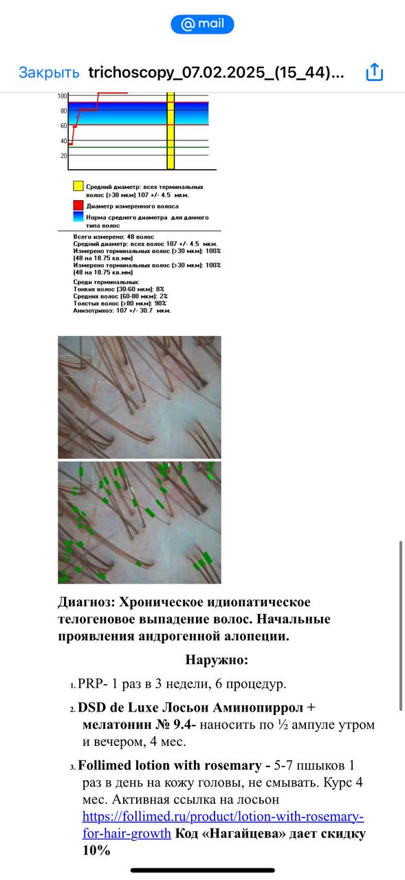 Увы нет,только сильнее и выпадение и зуд...