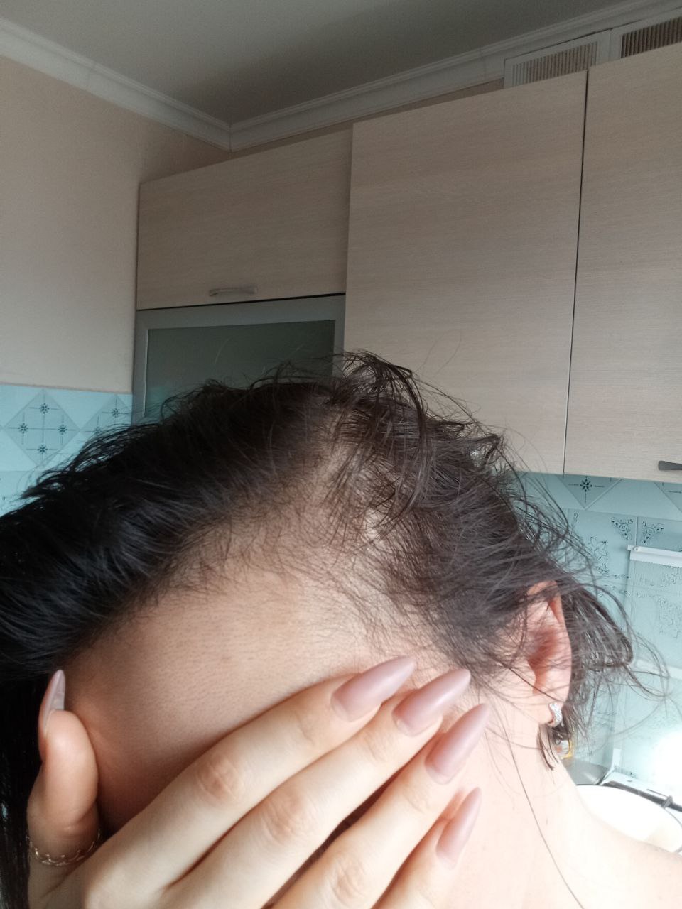 Вроде рецепт нужен на мин, у меня есть назначение только на русском языке...